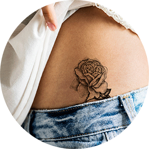 Psoriasis und Tattoos
